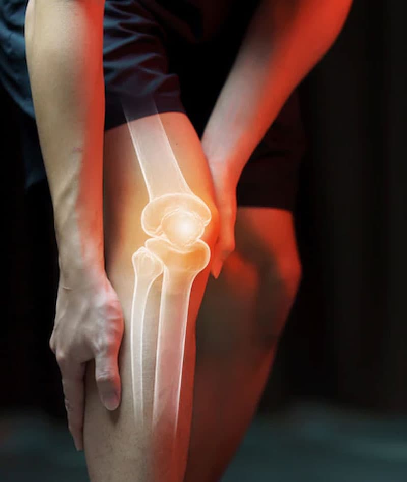 X-ray visualisation of painful knee joint